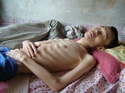 Image for article Mantan Guru Bahasa Inggris Dipecat Delapan Kali dan Hampir Meninggal Saat Menjalani Hukuman Tujuh Tahun Penjara karena Keyakinannya